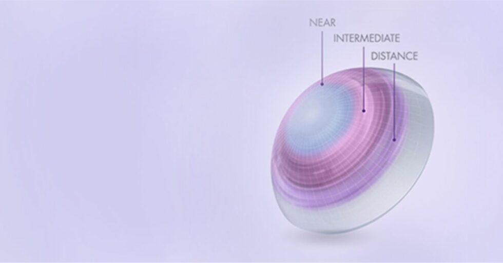 Are There Multifocal Contact Lenses? Boneham Optometrist